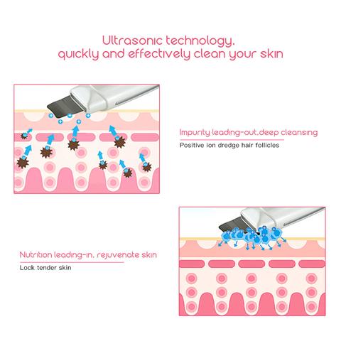 Ultrasonic skin scrubber spatula - alternate view 3